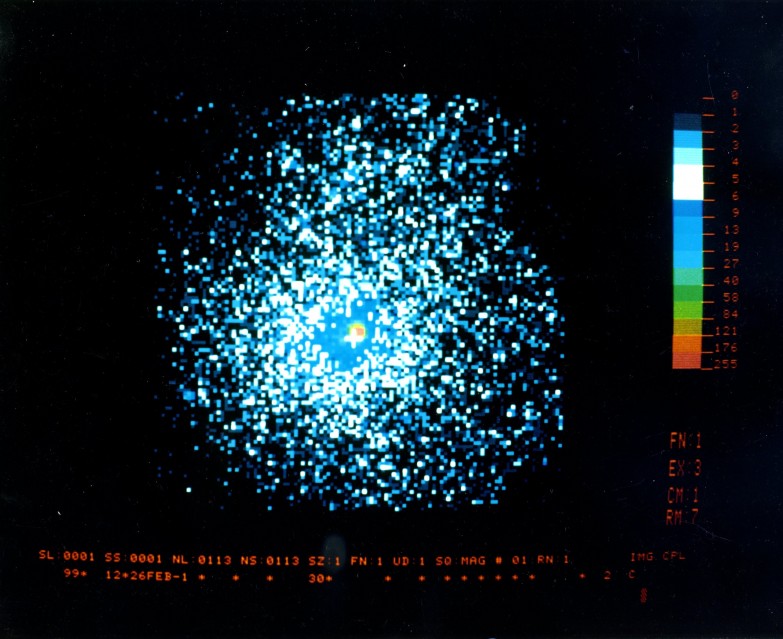 ESA ESTEC Supernova in Magellan, 1987 - Deep Space